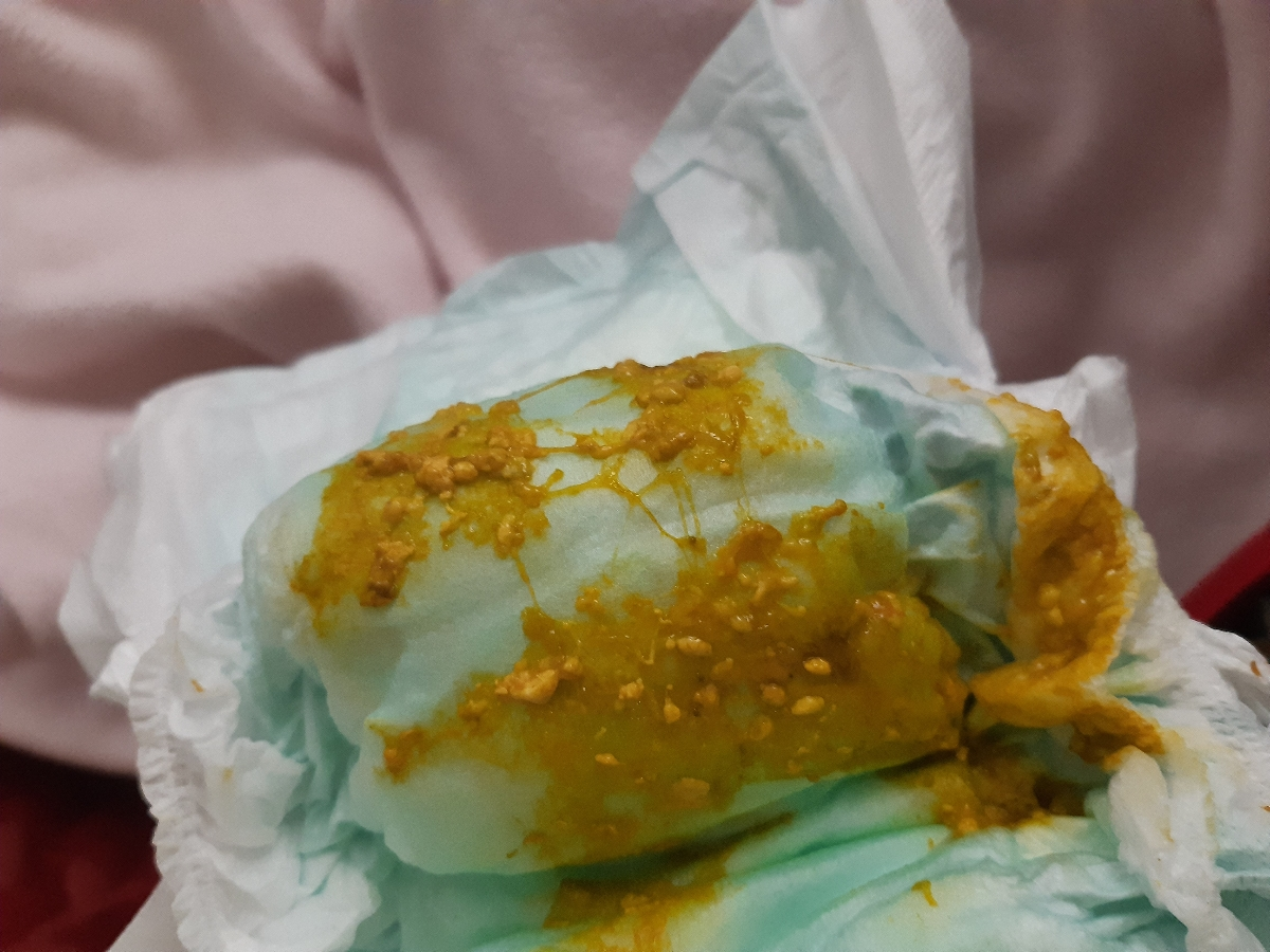 مدفوع نوزاد دو ماهه(با عکس) مدفوع نوزاد دو ماهه(با عکس)