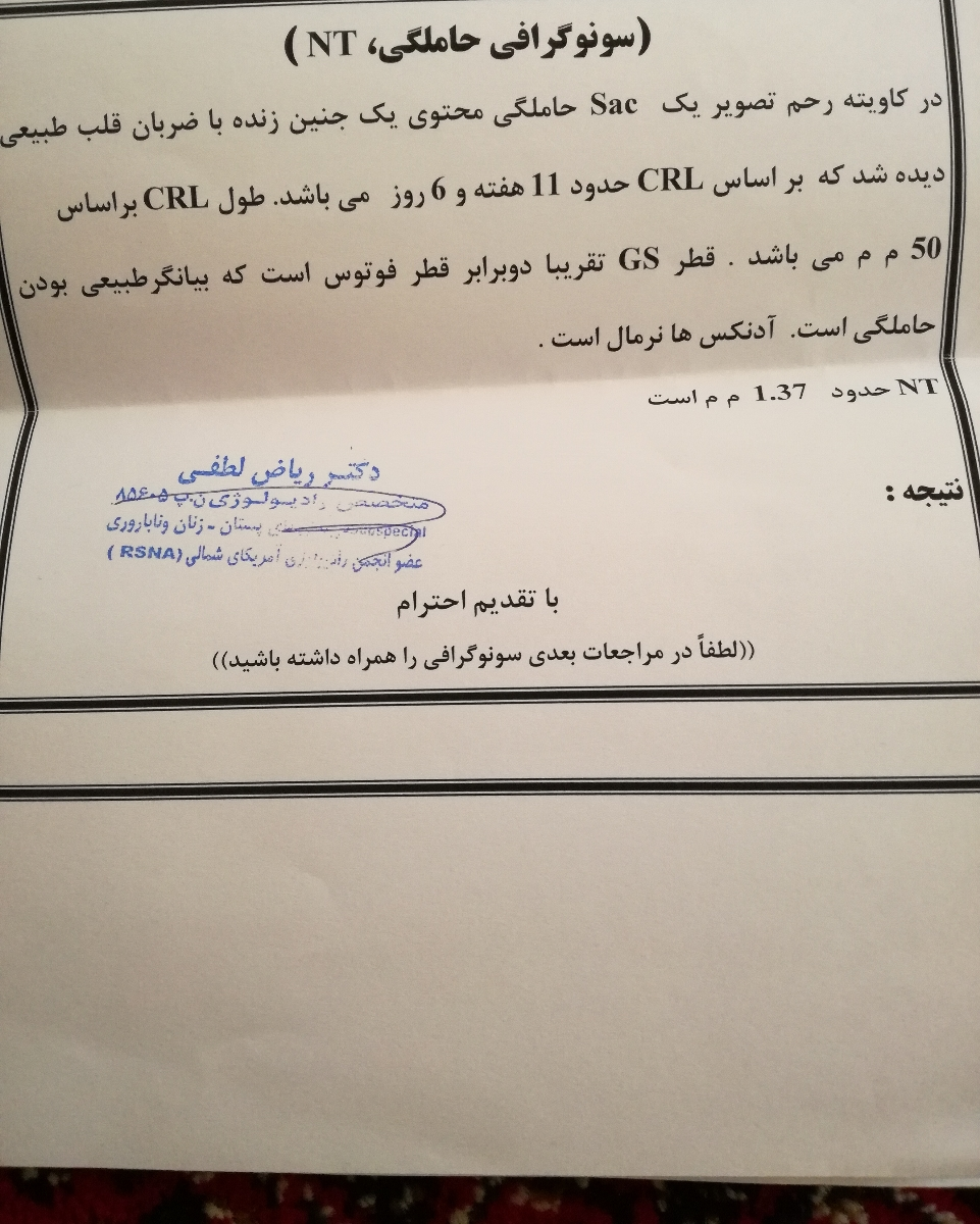 از مایش غرالگری مرحله اول از مایش غرالگری مرحله اول