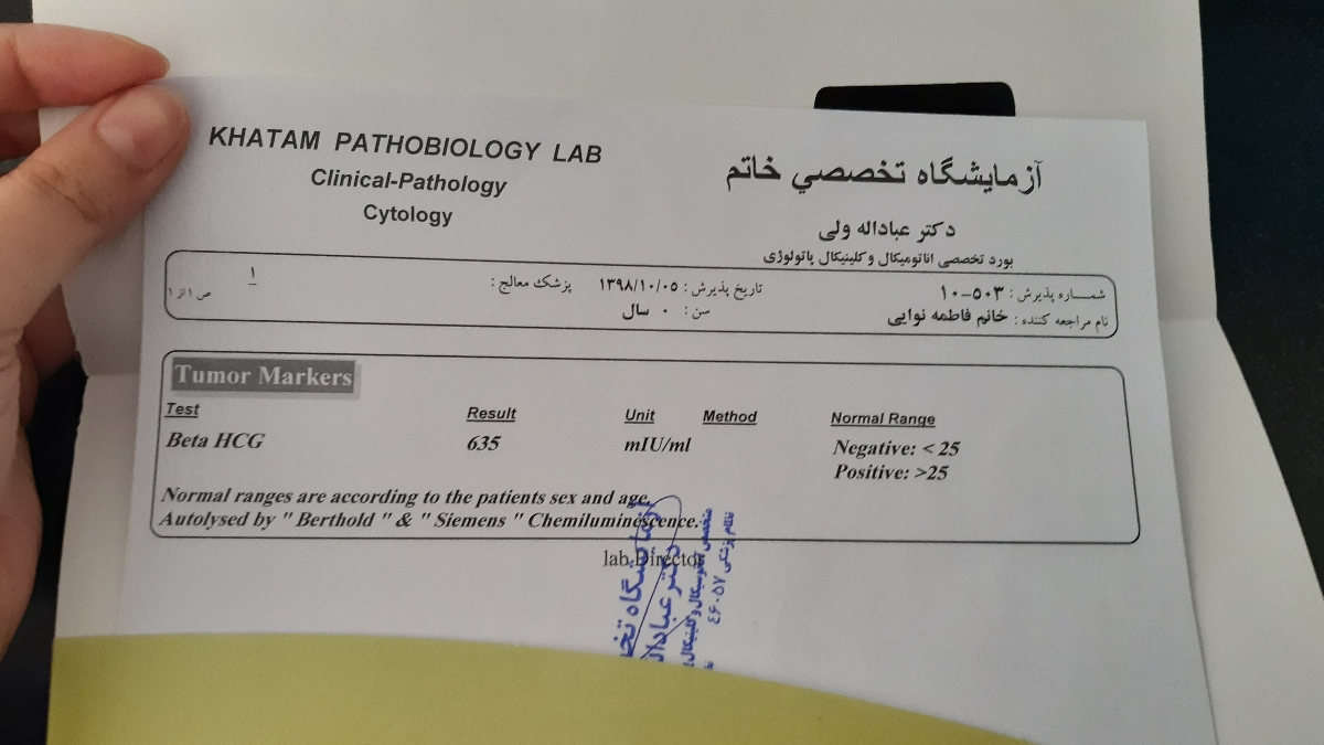 بی بی چک مثبته نه؟