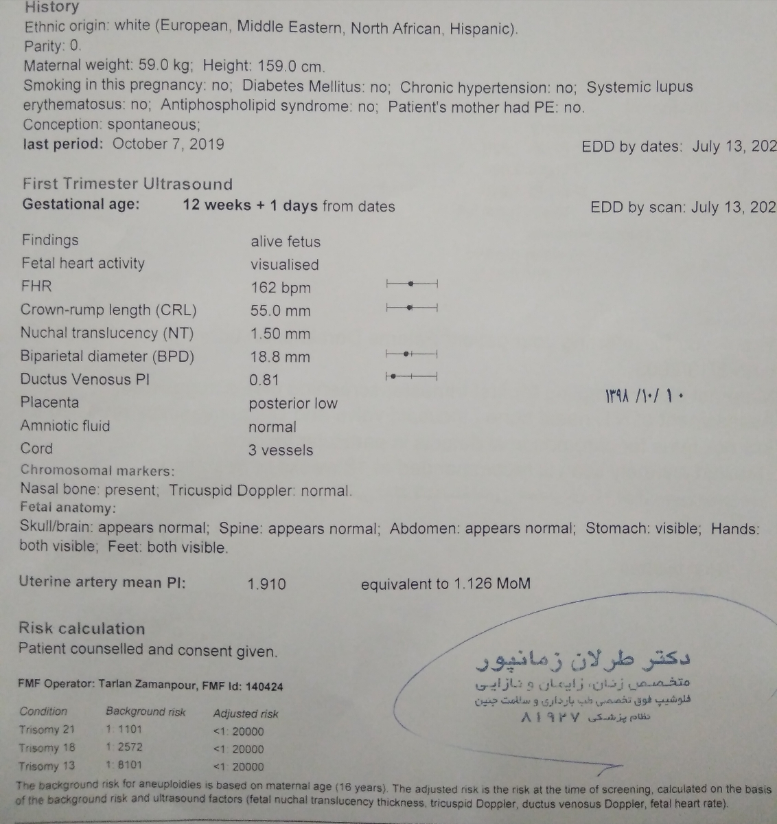 تفسیر سونو ان تی