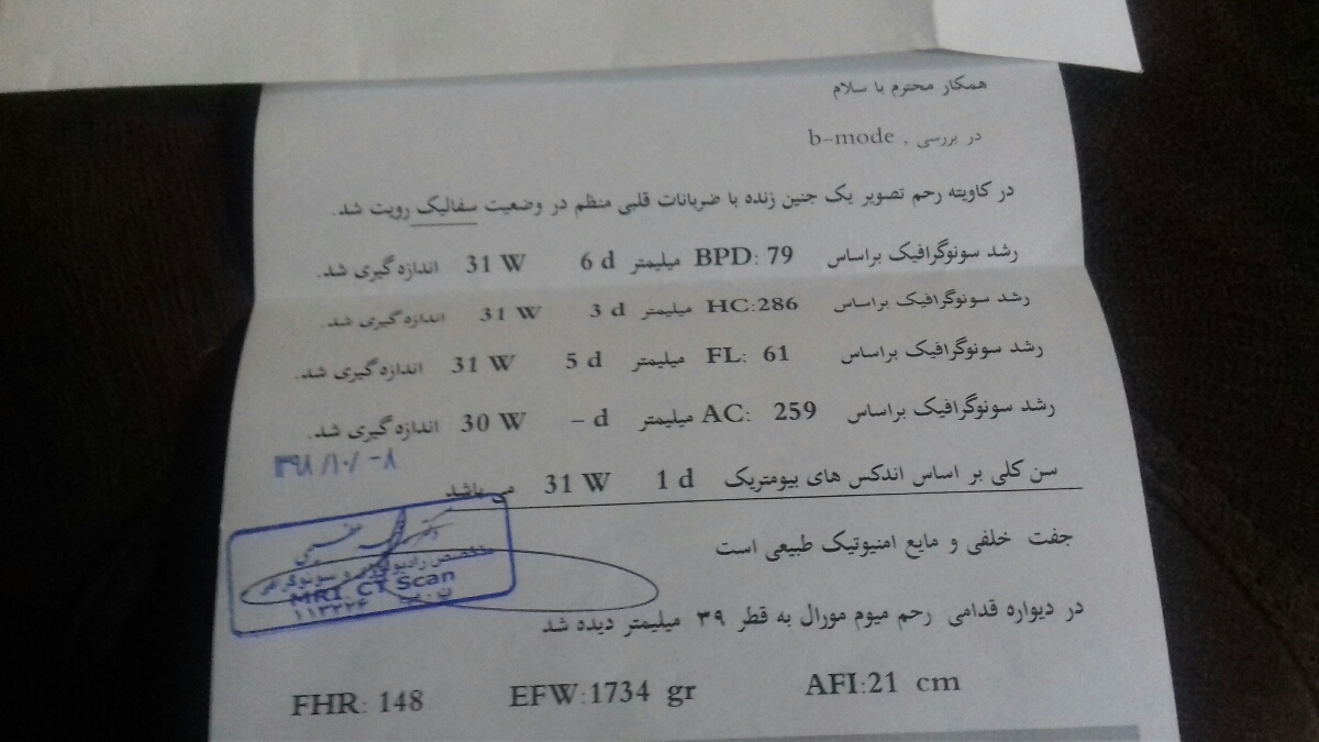 تفسیرسونوگرافی بیومتری هفته 31