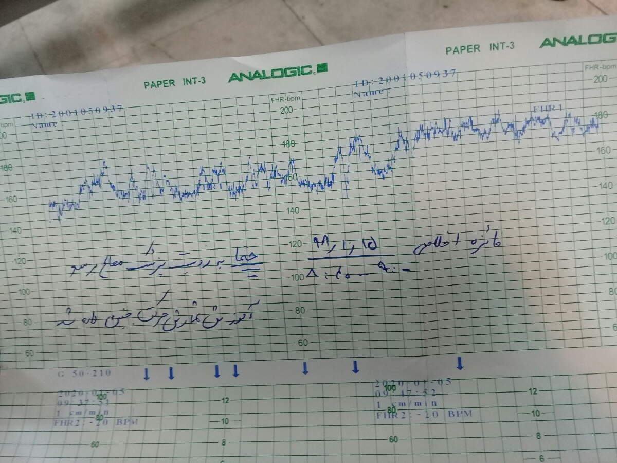 خانوم دکترمیشه این نوارقلبوببینید