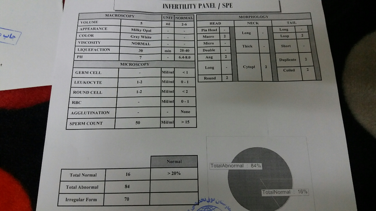 خانوامای عزیز کسی از ازمایش اسپرم سر در میاره