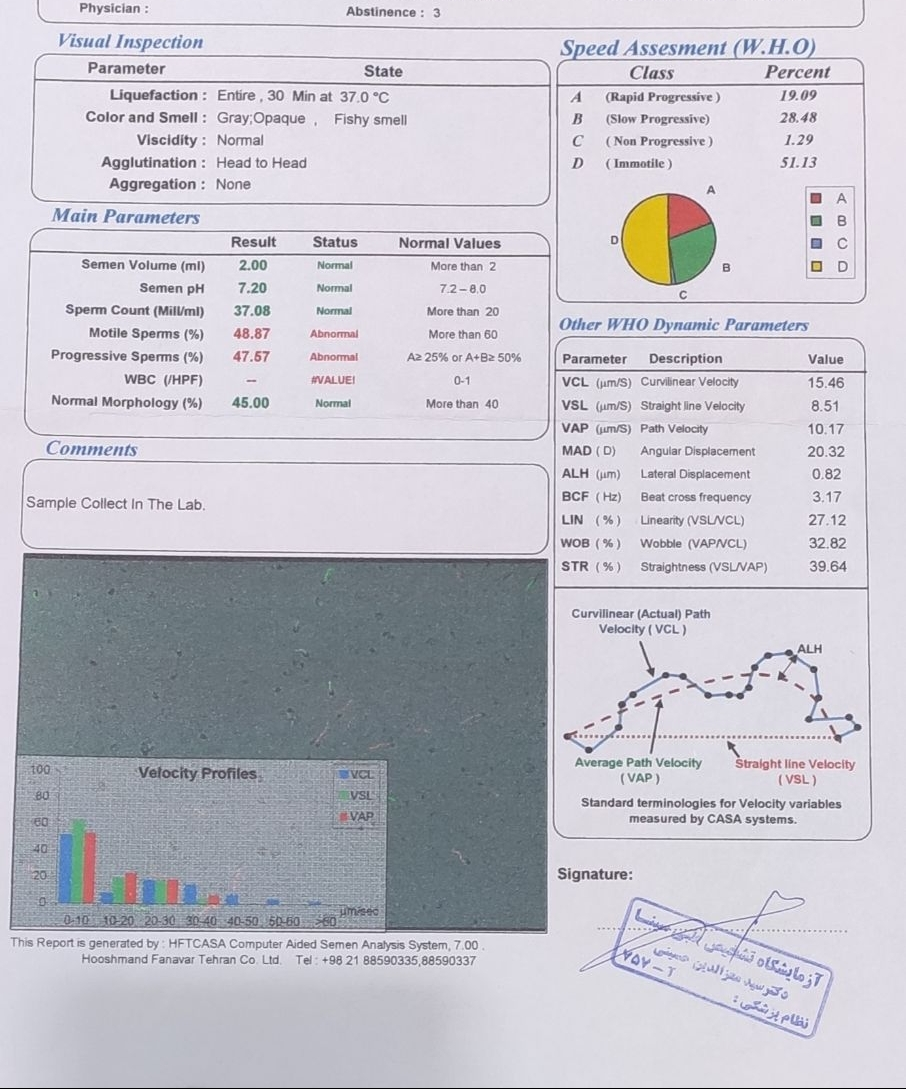 تفسیر آزمایش اسپرم ،راهنمایی میکنین؟