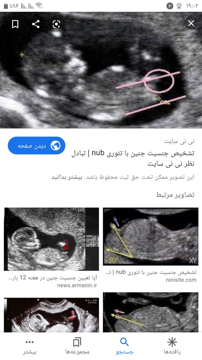 تعیین جنسیت از روی نظریه nub