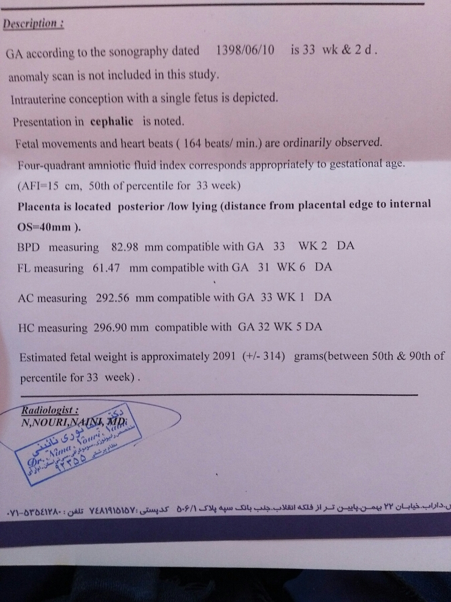 تفسیر سونو هفته سی وسه تفسیر سونو هفته سی وسه