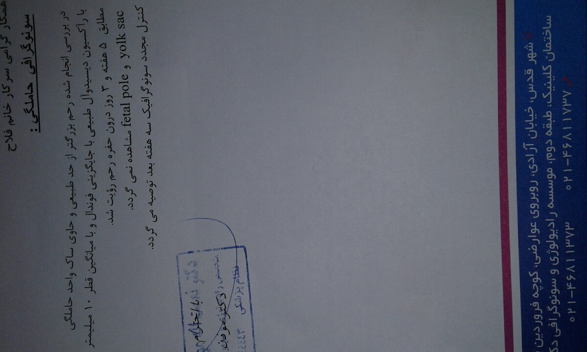 عدد بتا و تشکیل ساک عدد بتا و تشکیل ساک