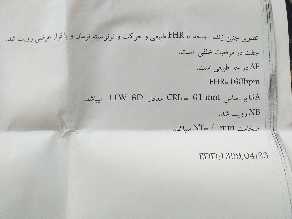 اضافه نشدن وزن بارداری