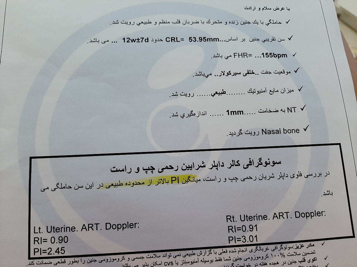 piبالاتراز محدوده طبیعی است