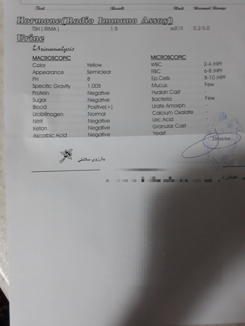 تفسیر آزمایش تیروئید و عفونت ادرار تفسیر آزمایش تیروئید و عفونت ادرار
