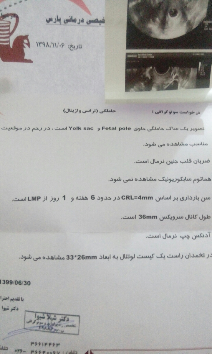 جواب سونوگرافی و سقط جنين جواب سونوگرافی و سقط جنين