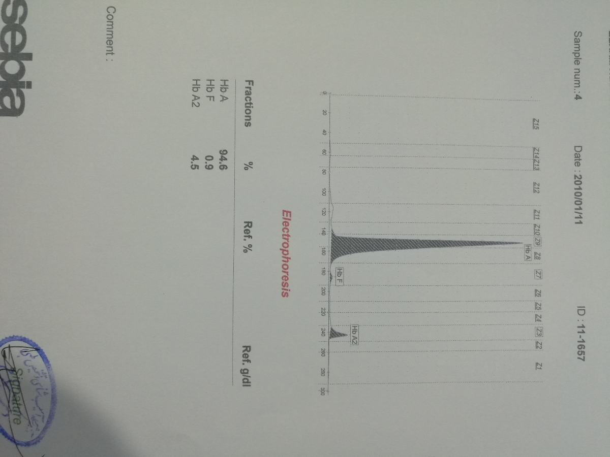 تفسیر آزمایش هورمونی و الکتروفور📢📢📢