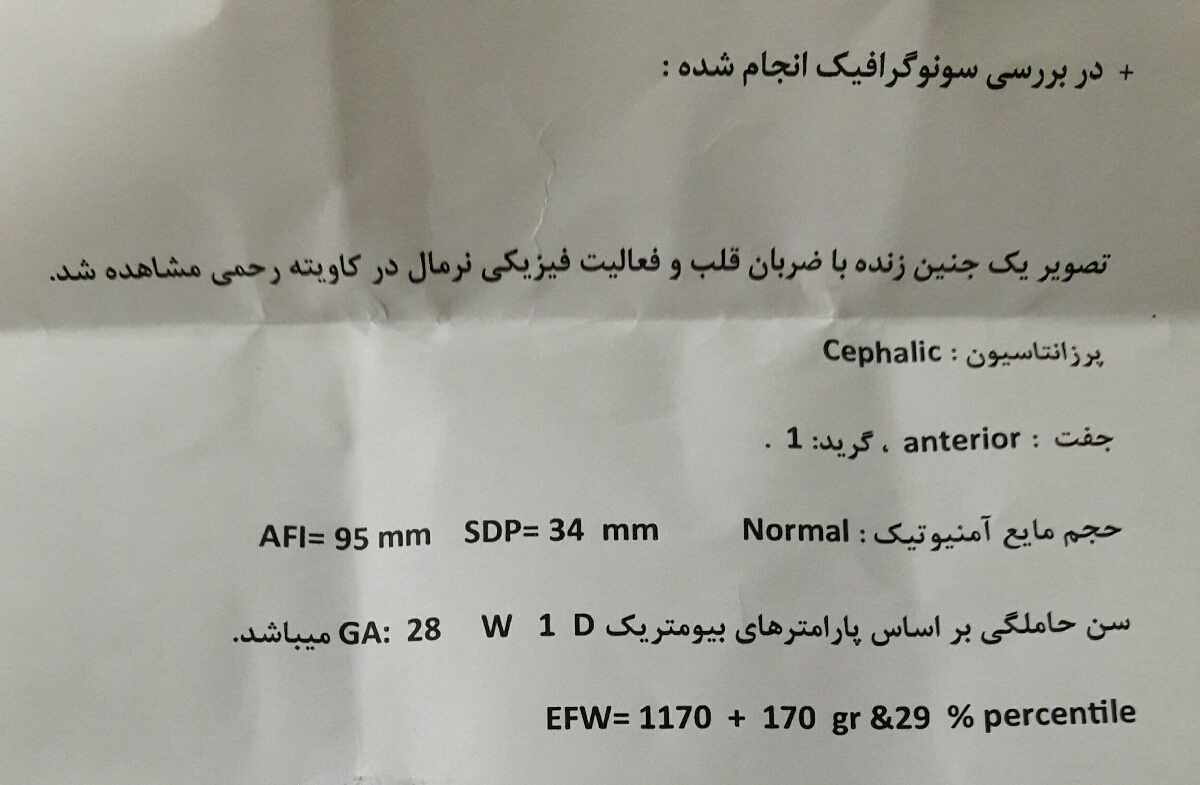 تفسیر سونو تفسیر سونو