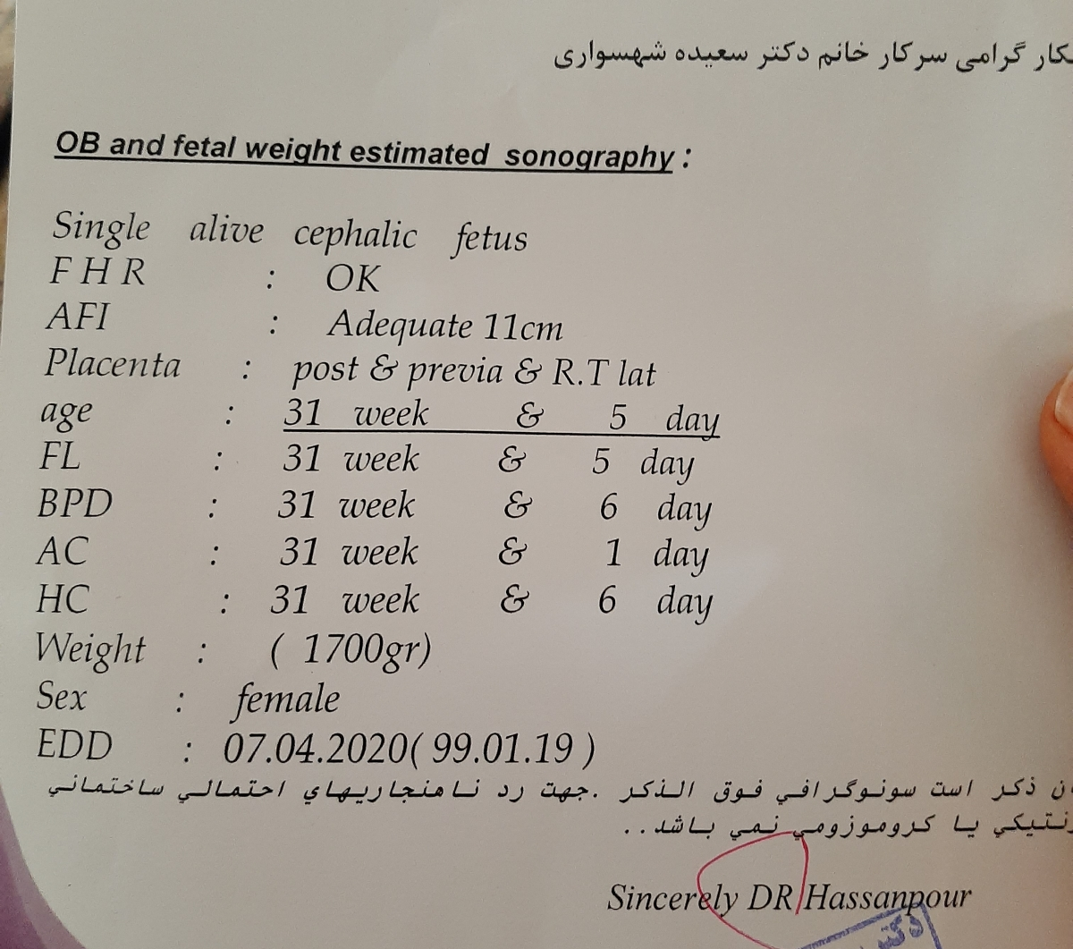 وضعیت جنین و جفت