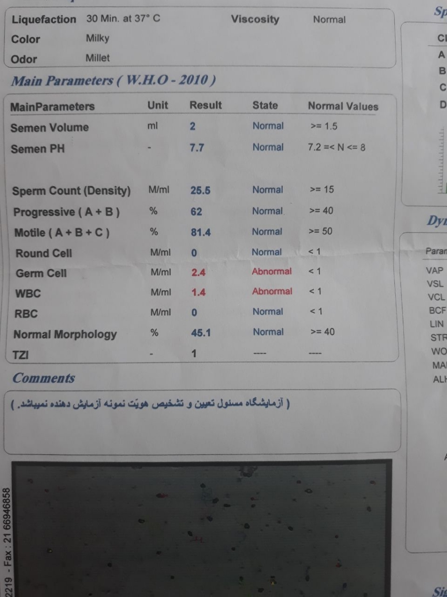 آزمایش اسپرم شوهر دوستم‌😊