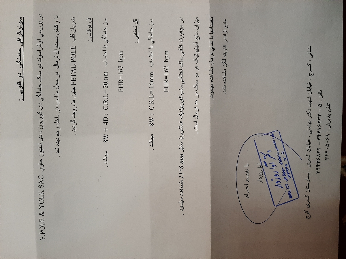 هماتوم در بارداری دو قلو هماتوم در بارداری دو قلو