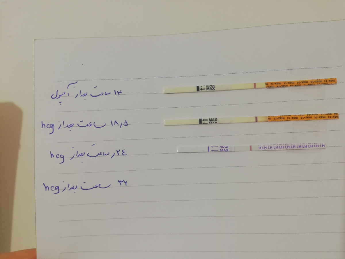 آمپول hcg و آزاد نشدن تخمک آمپول hcg و آزاد نشدن تخمک