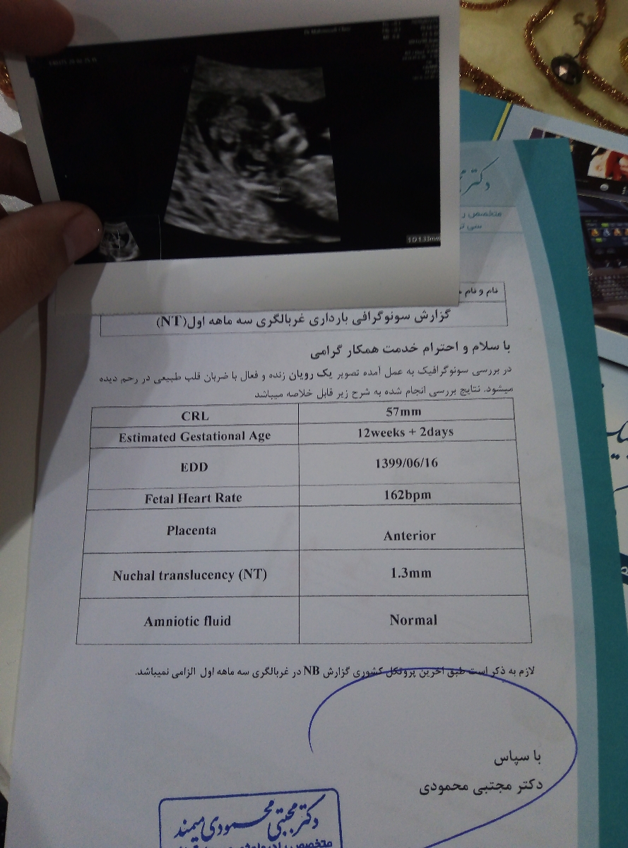 تفسیر جواب سونوی nt