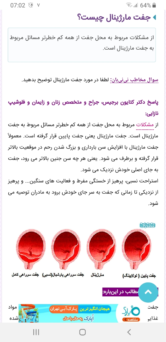 تفسیر سونو ان تی و تعیین جنسیت تفسیر سونو ان تی و تعیین جنسیت