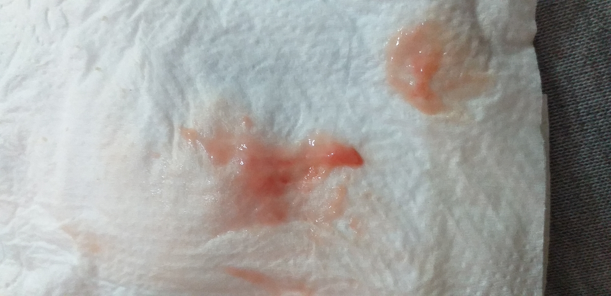 عکسه اگر کسی بدش میاد نبینه🙈 عکسه اگر کسی بدش میاد نبینه🙈
