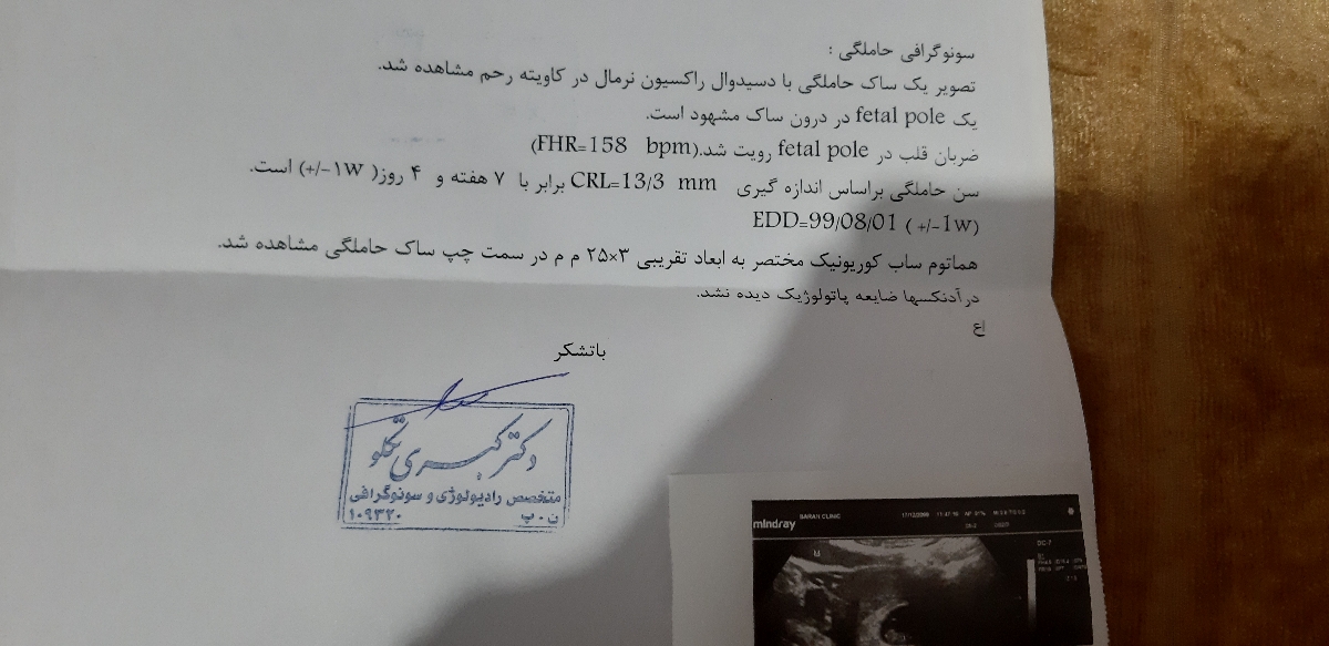 ❎❎خانمایی که هماتوم داشتین یه لحظه بیایینننن❎❎