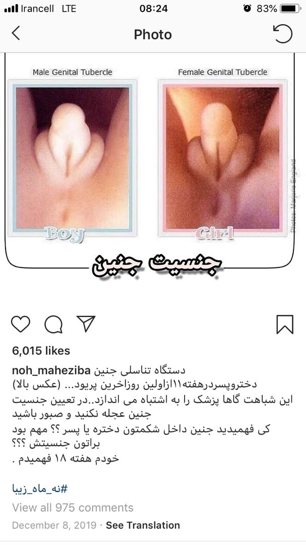 بچه ها شمام مث من شدین یافقط من اینجوری شدم بچه ها شمام مث من شدین یافقط من اینجوری شدم