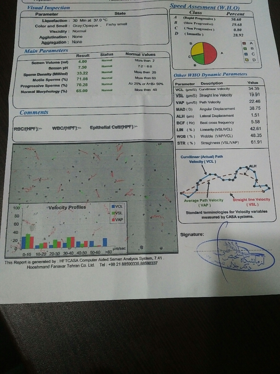 تفسیر آزمایش اسپرم همسرم تفسیر آزمایش اسپرم همسرم