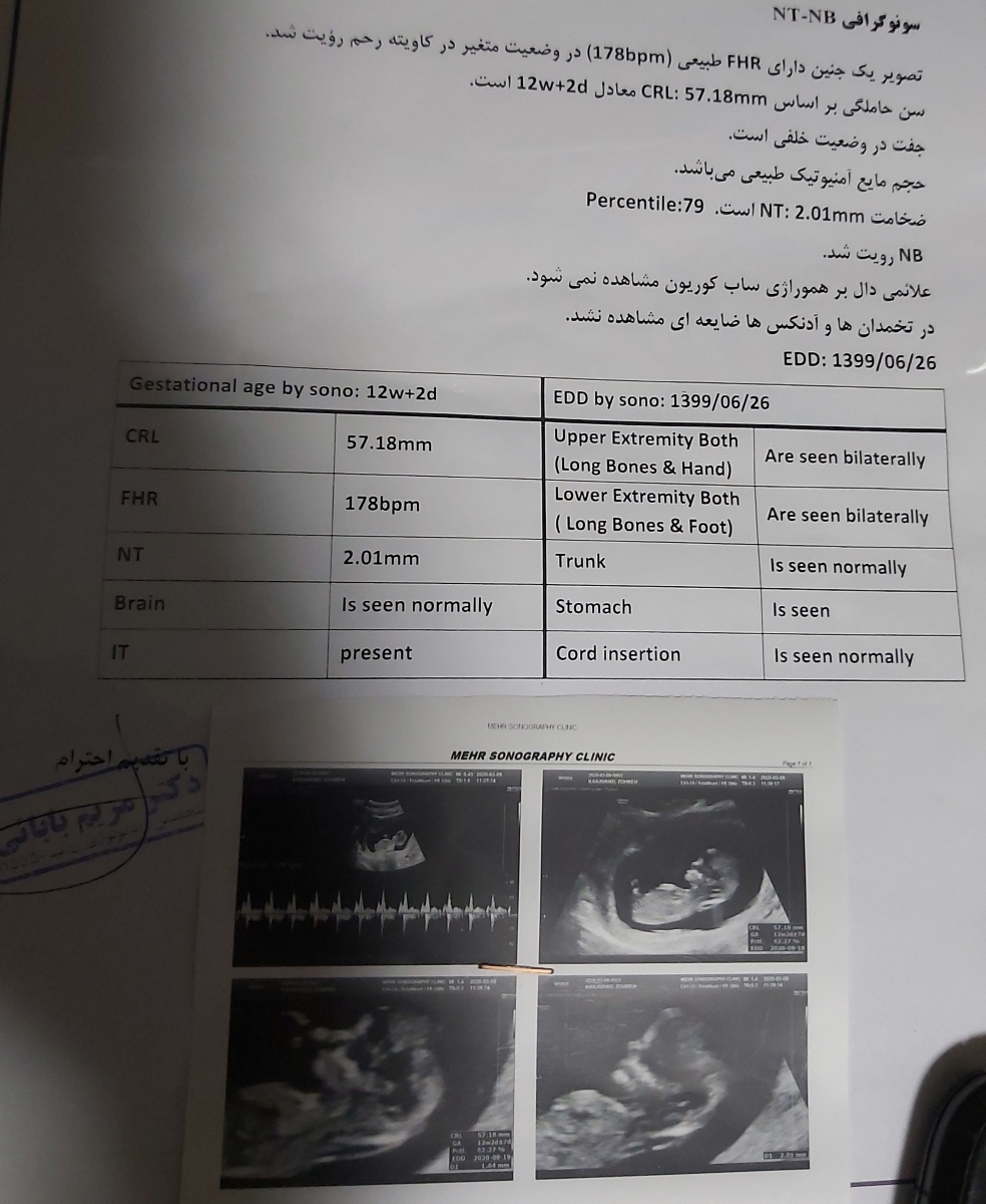 تفسیر آزمایش و سونوگرافی مرحله اول غربالگری