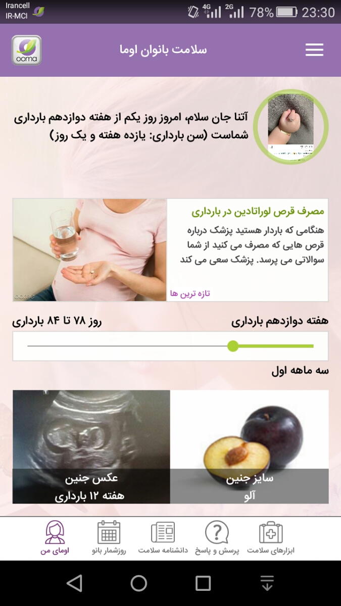 بچه ها ی لحظه بیاین ،امروز لک دیدم رفتم سونو ....