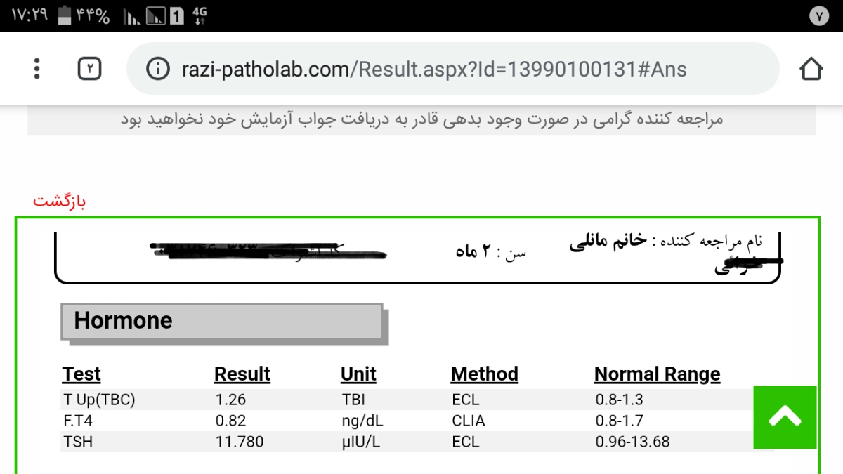 تیرویید نوزاد 2 ماهه