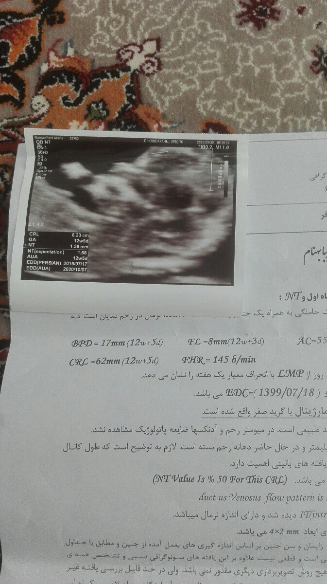 تفسیر سونو nt غربالگری