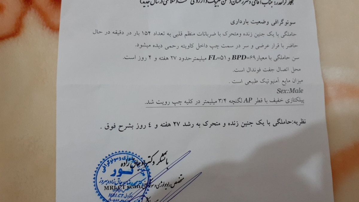پلیکتازی در سونگرافی هفته۲۸ پلیکتازی در سونگرافی هفته۲۸