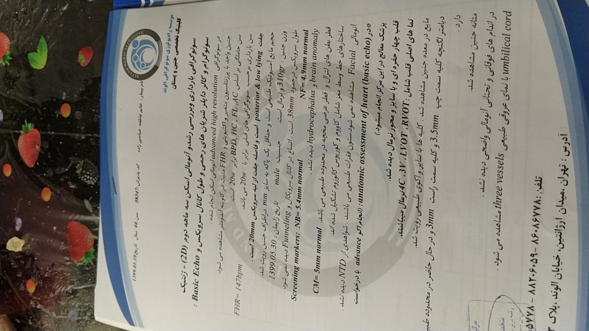تفسیر سونوگرافی بارداری و جفت تفسیر سونوگرافی بارداری و جفت