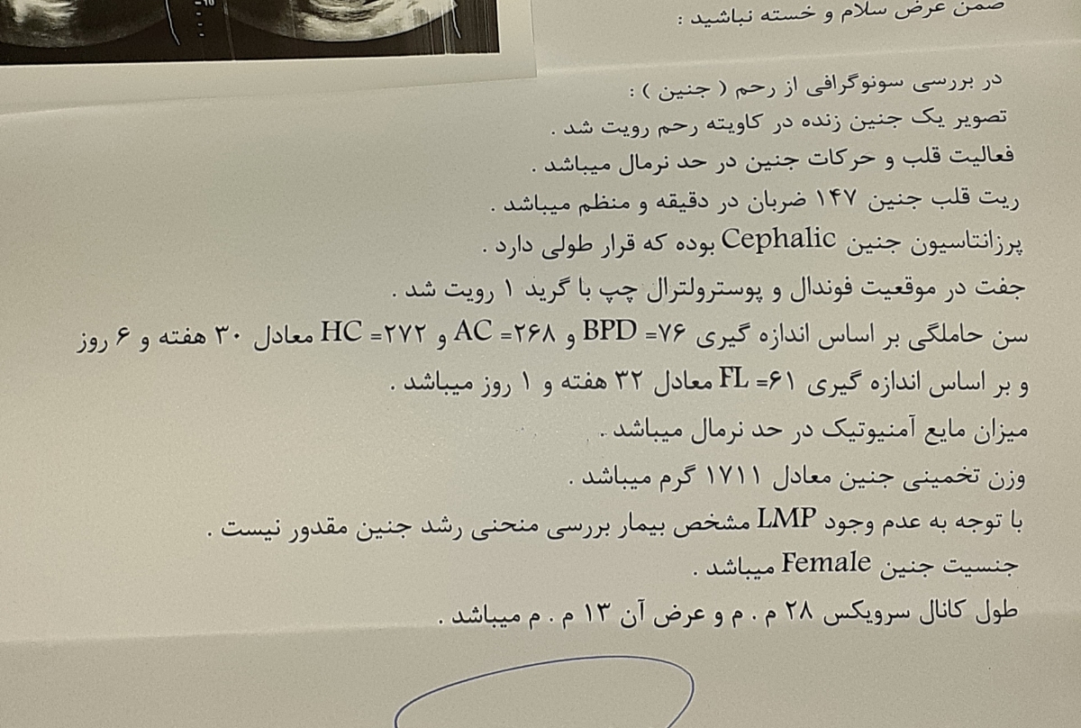 تفسیر سونوی ۳۲ هفته😘