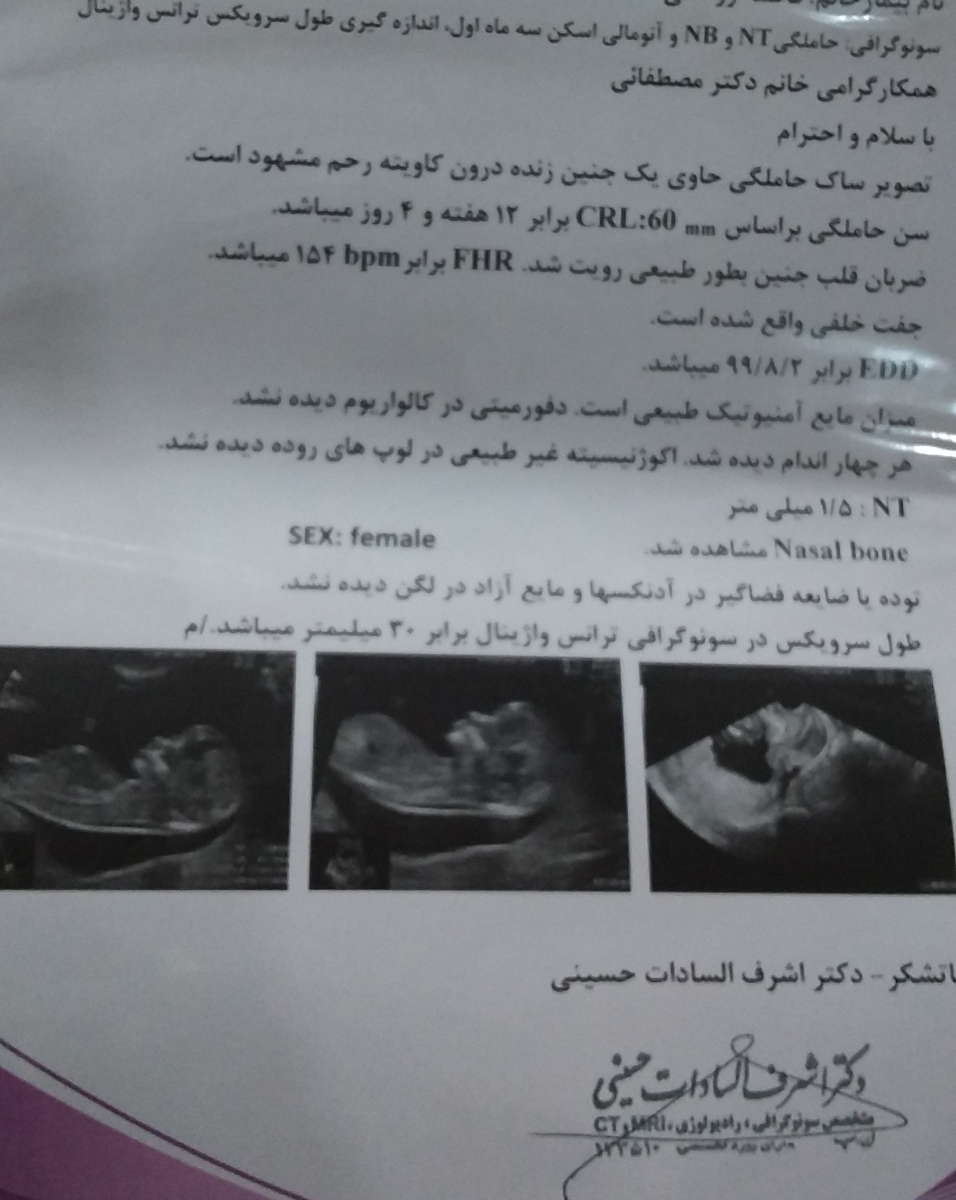 سوال دارم خانما کسی هس جواب بده