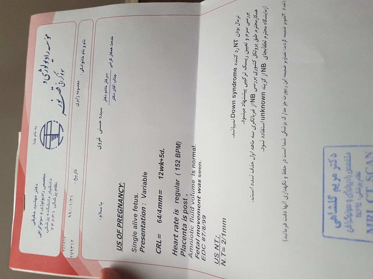 نتیجه سونو گرافی nt من چیست