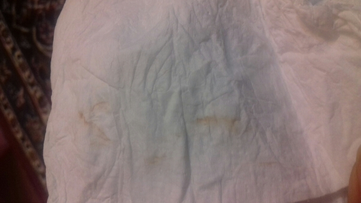 سلام آیااین لک لانه گزینی هست