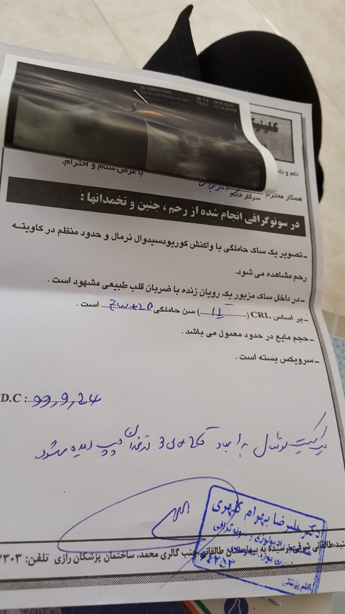 کیست تخمدان در بارداری ۷ هفتگی