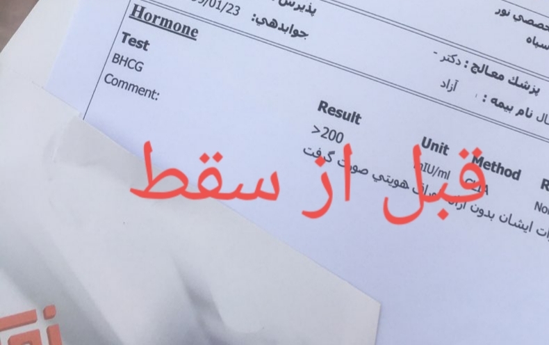 تیتر بتا و سونو شکمی بعد از سقط
