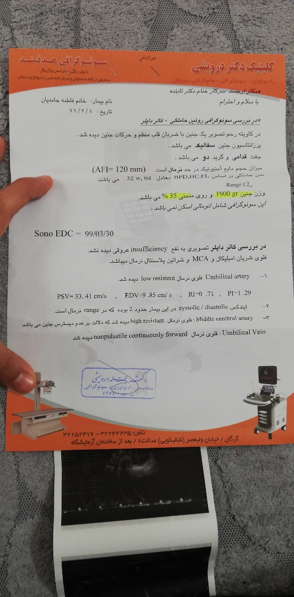 بررسی سونو وزن جنین بررسی سونو وزن جنین