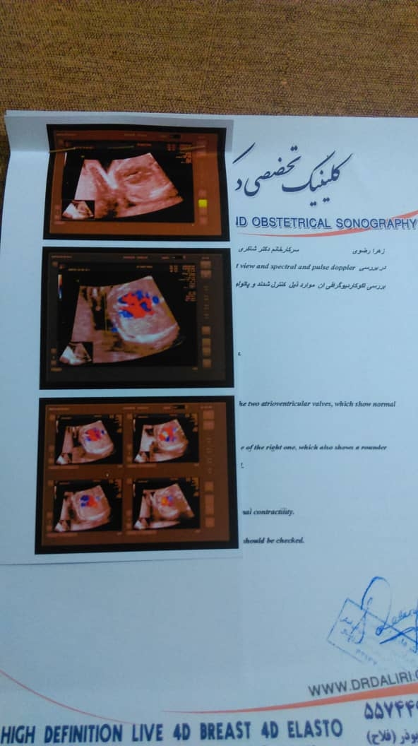سونوگرافی آنومالی و اکو قلب جنین سونوگرافی آنومالی و اکو قلب جنین