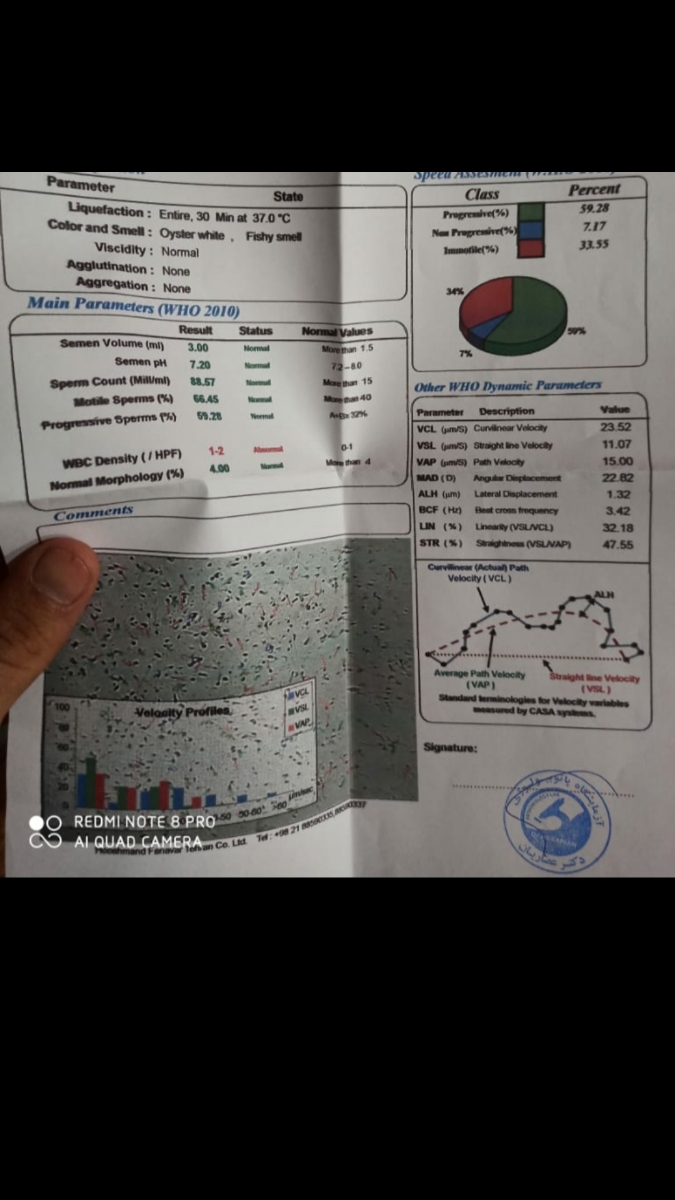 جواب اسپرم شوهرم رو تفسیر کنین جواب اسپرم شوهرم رو تفسیر کنین