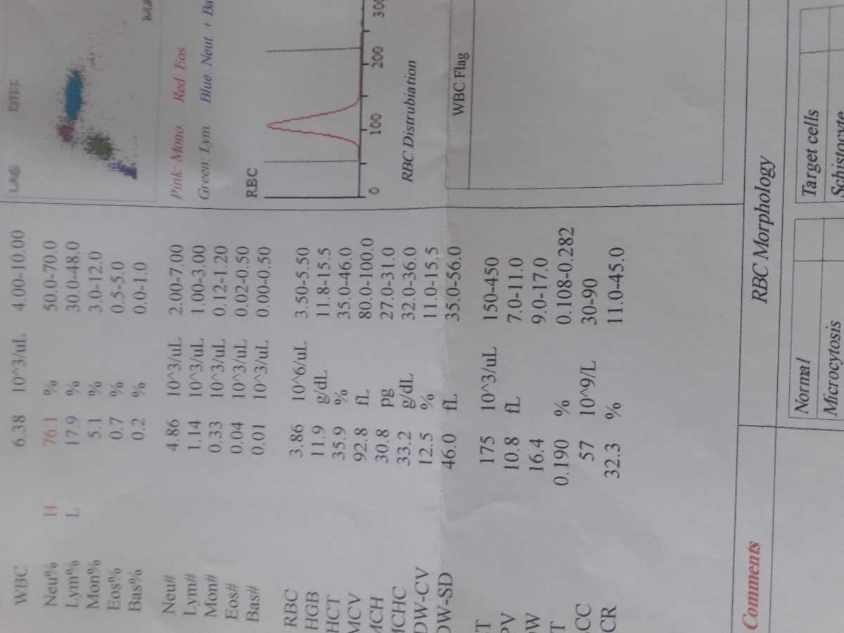 سلام گلها آزمایش تحمل گلوکزم چطوره سلام گلها آزمایش تحمل گلوکزم چطوره
