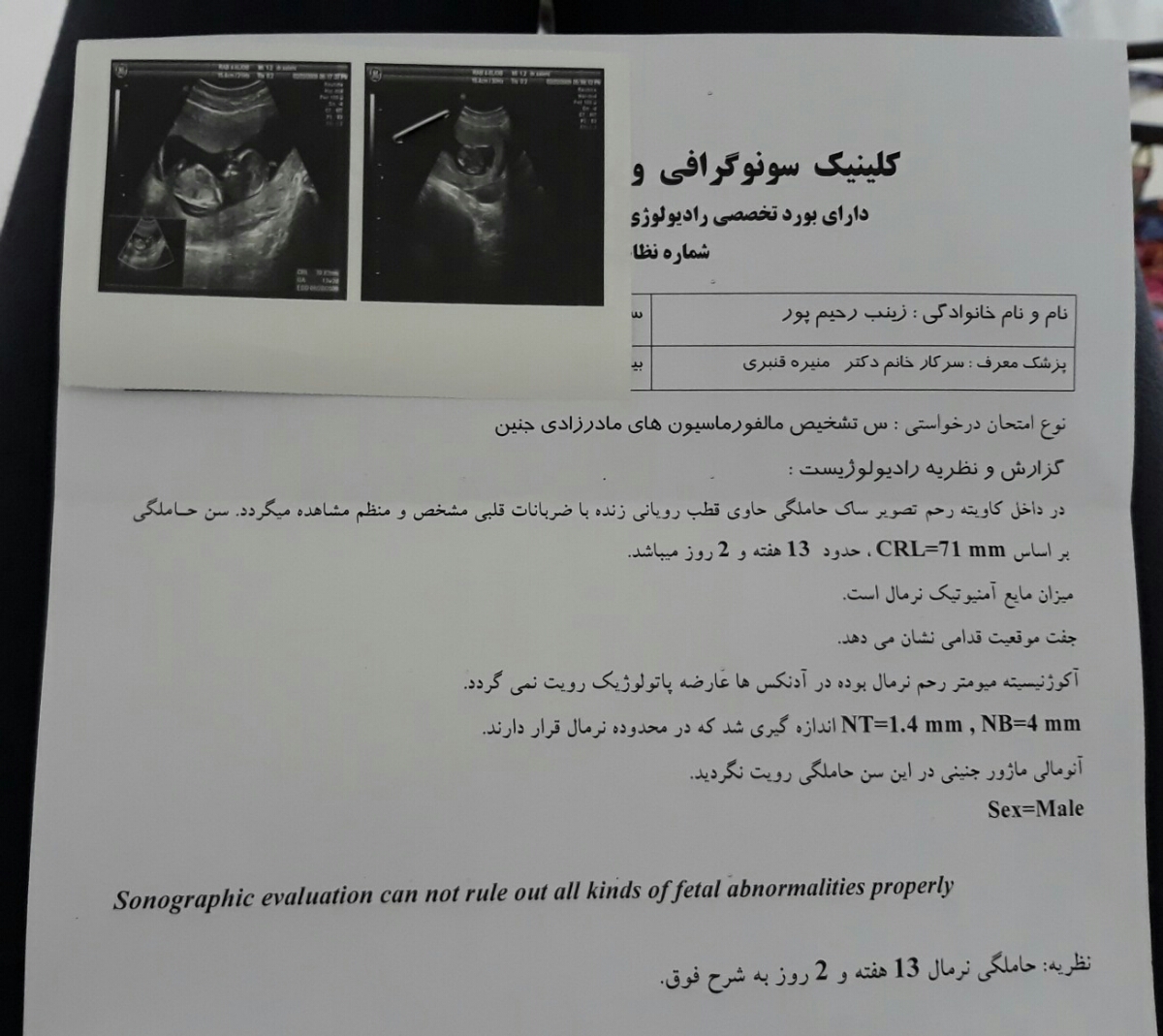 ازمایش غربالگری تو روخدا هرکس میتونه راهنمایی کنه