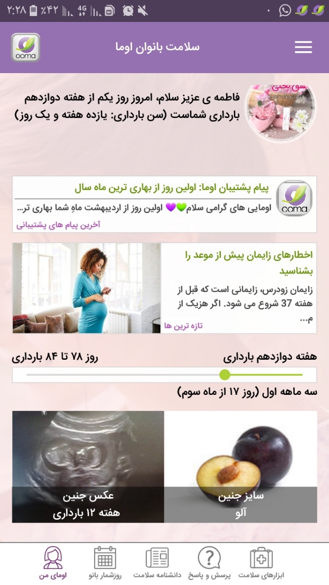 بهترین موقع برای سونوی ان تی سه ماهگی بهترین موقع برای سونوی ان تی سه ماهگی