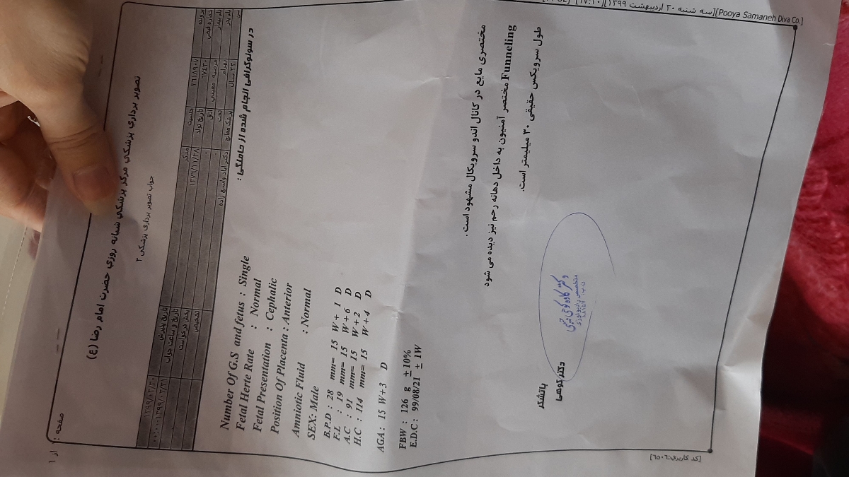 من امروز رفتم این سونو رو دادم میشه ی نگاه بندازین من امروز رفتم این سونو رو دادم میشه ی نگاه بندازین