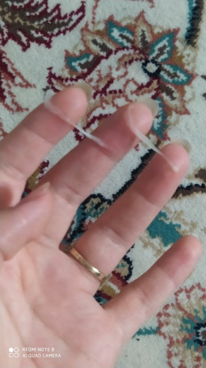 ترشح در بارداری