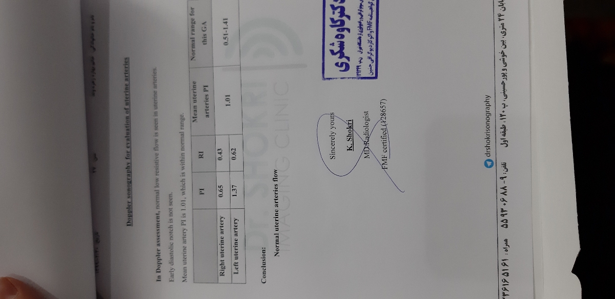 سونوگرافی انومالی هفته ۱۸ سونوگرافی انومالی هفته ۱۸