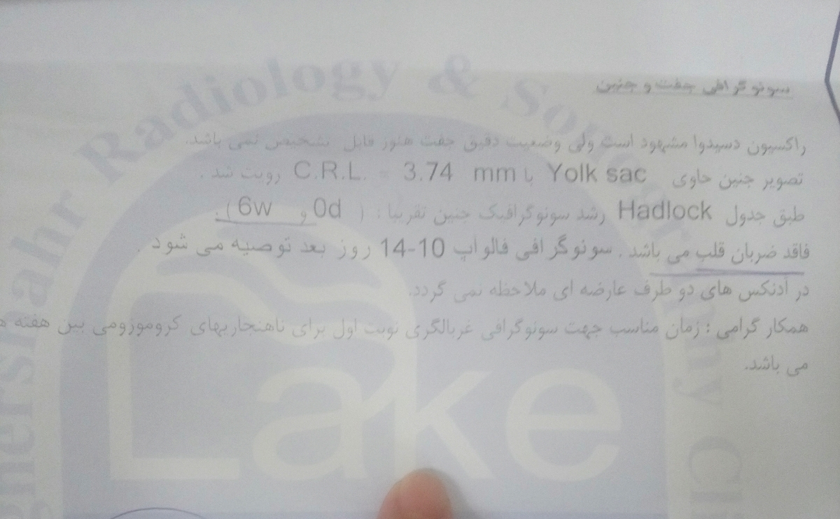 تعیین سن دقیق بارداری تعیین سن دقیق بارداری