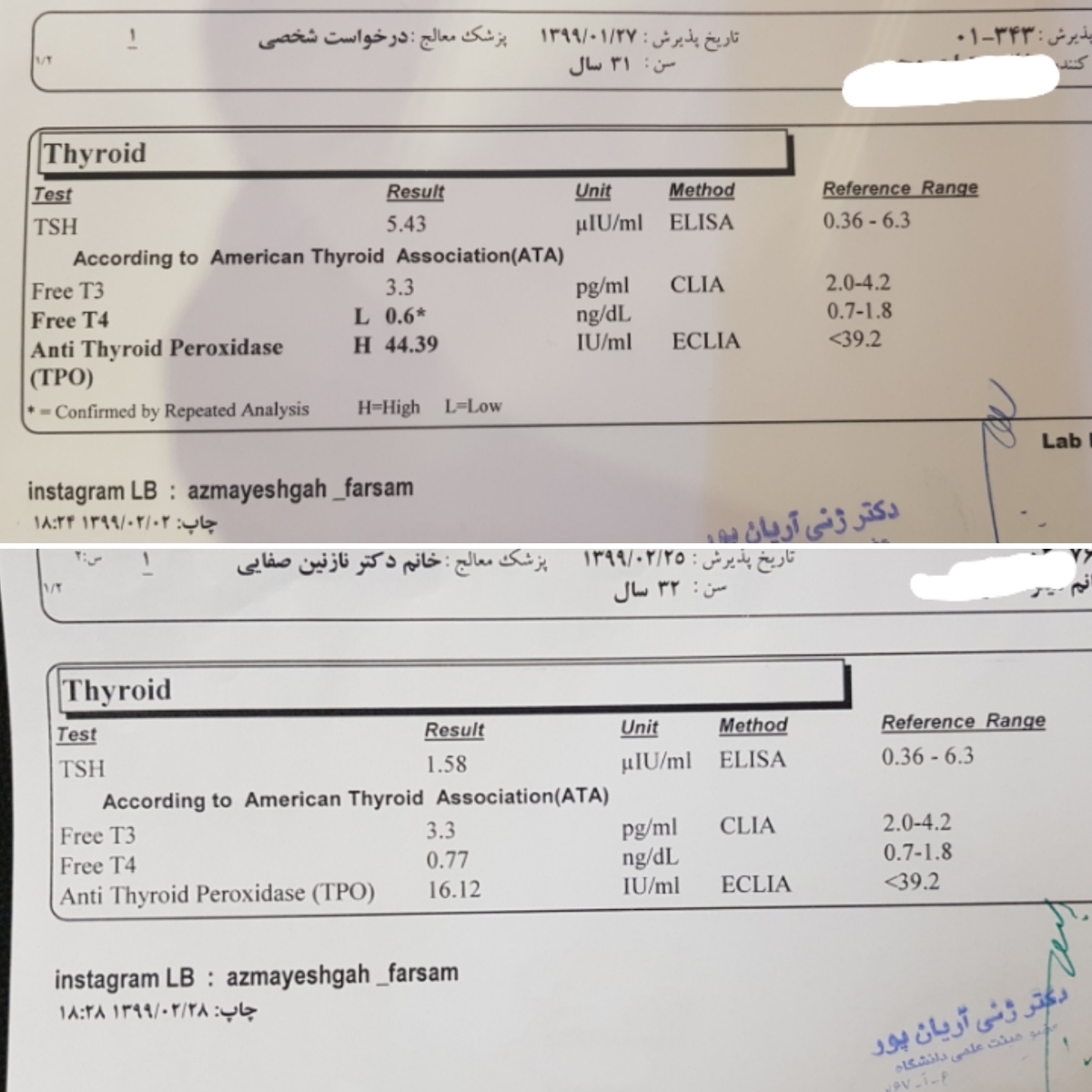 آیا تیروئیدم نرمال شده؟